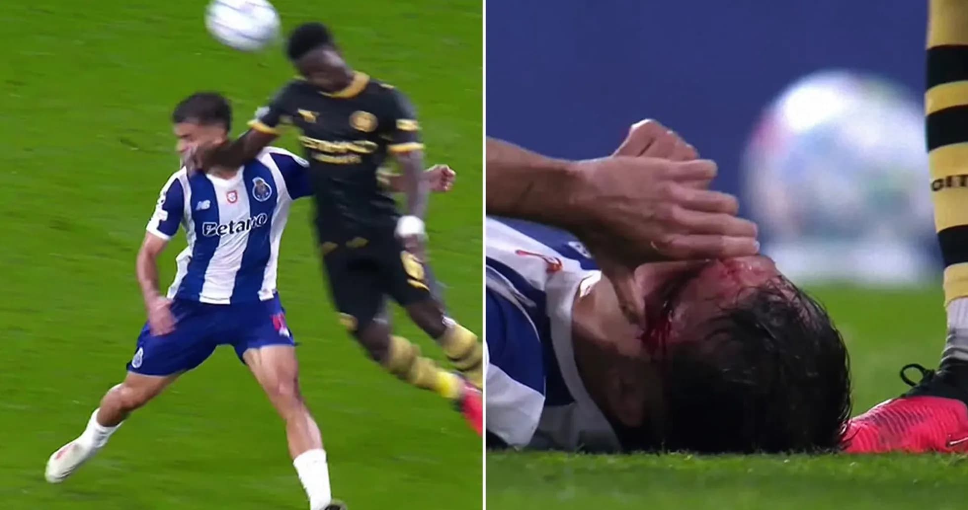 Player injured after collision during football match Player injured after collision during football match